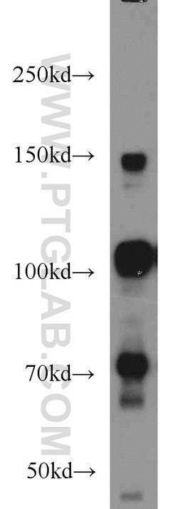 RBM15B Rabbit anti-Human, Mouse, Rat, Polyclonal, Proteintech 150 &mu;L;