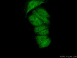FAM98B Rabbit anti-Human, Mouse, Polyclonal, Proteintech 150 &mu;L; Unconjugated:Antibodies,