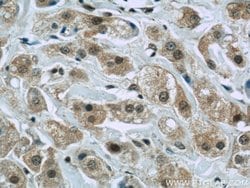FAM98B Rabbit anti-Human, Mouse, Polyclonal, Proteintech 150 &mu;L; Unconjugated:Antibodies,