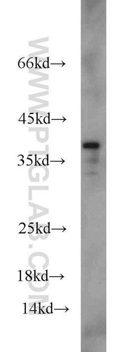 FAM98B Rabbit anti-Human, Mouse, Polyclonal, Proteintech 150 &mu;L; Unconjugated:Antibodies,