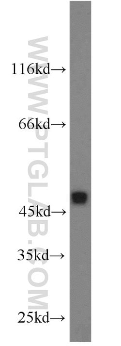 FAM98B Rabbit anti-Human, Mouse, Polyclonal, Proteintech 150 &mu;L; Unconjugated:Antibodies,