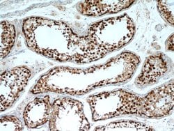 TSPY3 Rabbit anti-Human, Polyclonal, Proteintech:Antibodies:Primary Antibodies