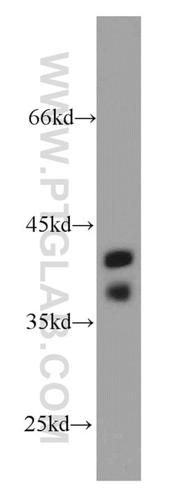 TSPY3 Rabbit anti-Human, Polyclonal, Proteintech:Antibodies:Primary Antibodies