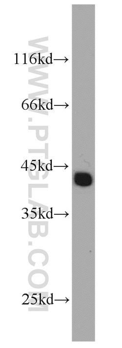 TSPY3 Rabbit anti-Human, Polyclonal, Proteintech:Antibodies:Primary Antibodies