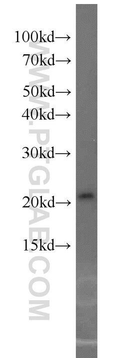 ASF1A Rabbit anti-Human, Mouse, Rat, Polyclonal, Proteintech:Antibodies:Primary
