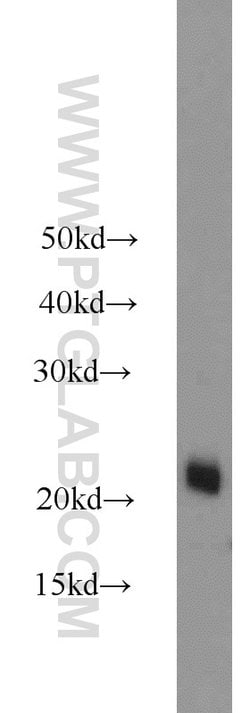 ASF1A Rabbit anti-Human, Mouse, Rat, Polyclonal, Proteintech:Antibodies:Primary