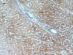 Polycystin 1 Rabbit anti-Human, Mouse, Polyclonal, Proteintech:Antibodies:Primary
