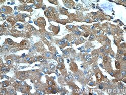 Polycystin 1 Rabbit anti-Human, Mouse, Polyclonal, Proteintech:Antibodies:Primary