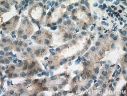 Polycystin 1 Rabbit anti-Human, Mouse, Polyclonal, Proteintech:Antibodies:Primary