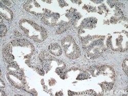 CALML6 Rabbit anti-Human, Polyclonal, Proteintech:Antibodies:Primary Antibodies