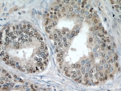 CALML6 Rabbit anti-Human, Polyclonal, Proteintech:Antibodies:Primary Antibodies