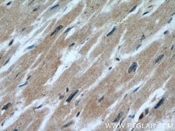 CALML6 Rabbit anti-Human, Polyclonal, Proteintech:Antibodies:Primary Antibodies