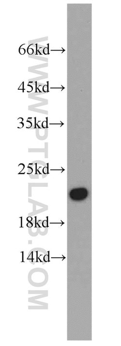CALML6 Rabbit anti-Human, Polyclonal, Proteintech:Antibodies:Primary Antibodies