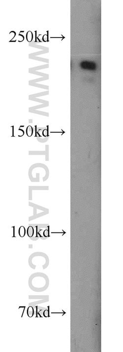 CACNA1S Rabbit anti-Human, Polyclonal, Proteintech 20 &mu;L | Buy Online | Proteintech | Fisher Scientific