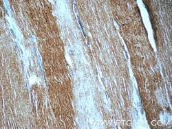 MYH1-internal Rabbit anti-Human, Polyclonal, Proteintech:Antibodies:Primary