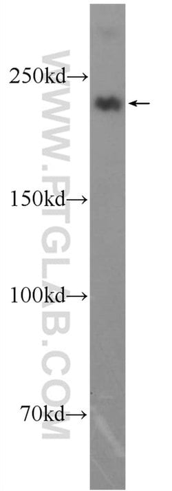 MYH1-internal Rabbit anti-Human, Polyclonal, Proteintech:Antibodies:Primary