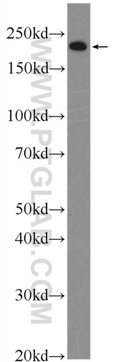 MYH3 Rabbit anti-Human, Mouse, Polyclonal, Proteintech 150 &mu;L; Unconjugated:Antibodies,