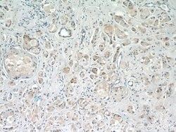 ARF3 Rabbit anti-Human, Mouse, Rat, Polyclonal, Proteintech 150 &mu;L;