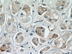 ARF3 Rabbit anti-Human, Mouse, Rat, Polyclonal, Proteintech 150 &mu;L;