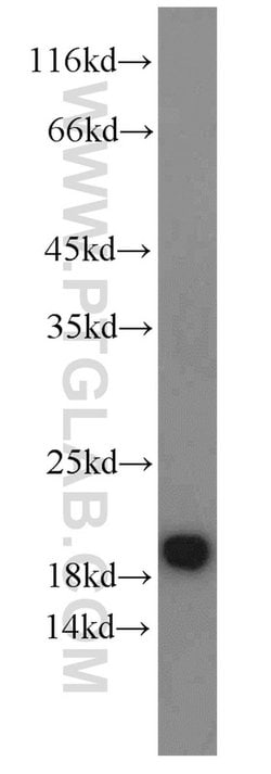 ARF3 Rabbit anti-Human, Mouse, Rat, Polyclonal, Proteintech 150 &mu;L;