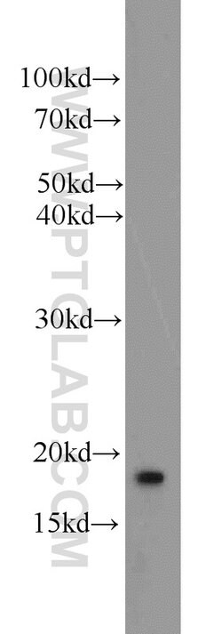 ARF3 Rabbit anti-Human, Mouse, Rat, Polyclonal, Proteintech 150 &mu;L;