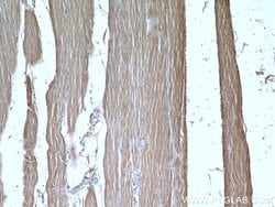 SAR1B Rabbit anti-Human, Mouse, Rat, Polyclonal, Proteintech 150 &mu;L;