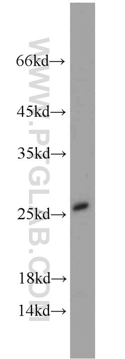 SAR1B Rabbit anti-Human, Mouse, Rat, Polyclonal, Proteintech 150 &mu;L;