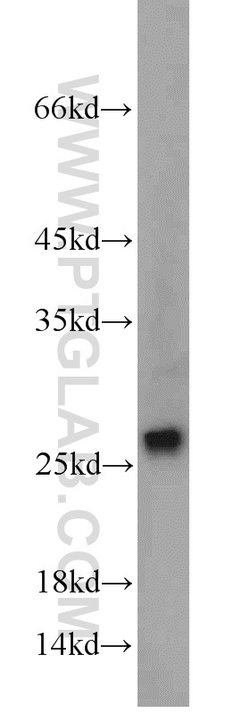 SAR1B Rabbit anti-Human, Mouse, Rat, Polyclonal, Proteintech 150 &mu;L;
