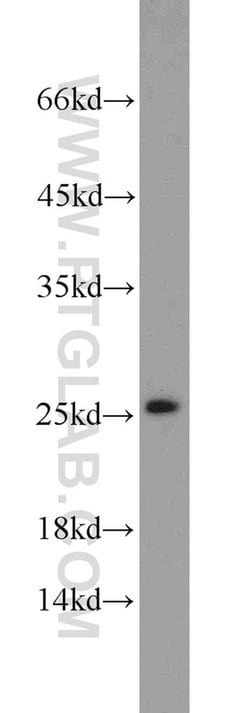 SAR1B Rabbit anti-Human, Mouse, Rat, Polyclonal, Proteintech 150 &mu;L;