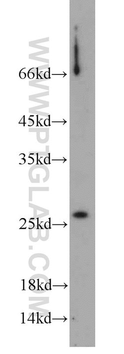 SAR1B Rabbit anti-Human, Mouse, Rat, Polyclonal, Proteintech 150 &mu;L;