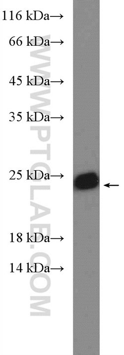 SAR1B Rabbit anti-Human, Mouse, Rat, Polyclonal, Proteintech 150 &mu;L;