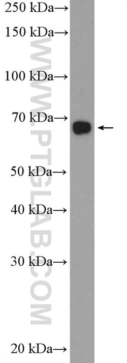 PBX2 Rabbit anti-Human, Polyclonal, Proteintech 150 &mu;L | Buy Online | Proteintech Group Inc | Fisher Scientific