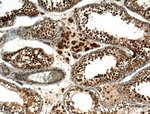 Thumbnail_SMN Rabbit anti-Human, Polyclonal, Proteintech 150 &mu;L; Unconjugated:Anticorps,