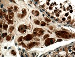Thumbnail_SMN Rabbit anti-Human, Polyclonal, Proteintech 150 &mu;L; Unconjugated:Anticorps,