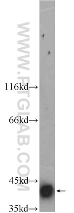 Thumbnail_SMN Rabbit anti-Human, Polyclonal, Proteintech 150 &mu;L; Unconjugated:Anticorps,