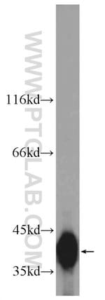 Thumbnail_SMN Rabbit anti-Human, Polyclonal, Proteintech 150 &mu;L; Unconjugated:Anticorps,