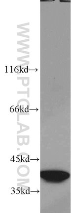 Thumbnail_SMN Rabbit anti-Human, Polyclonal, Proteintech 150 &mu;L; Unconjugated:Anticorps,
