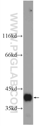 Thumbnail_SMN Rabbit anti-Human, Polyclonal, Proteintech 150 &mu;L; Unconjugated:Anticorps,