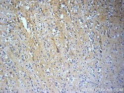 TACR3 Rabbit anti-Human, Polyclonal, Proteintech 150 &mu;L | Buy Online | Proteintech Group Inc | Fisher Scientific