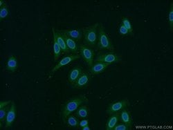 RCC1 Rabbit anti-Human, Mouse, Rat, Polyclonal, Proteintech:Antibodies:Primary