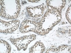 RCC1 Rabbit anti-Human, Mouse, Rat, Polyclonal, Proteintech:Antibodies:Primary