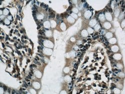 RCC1 Rabbit anti-Human, Mouse, Rat, Polyclonal, Proteintech:Antibodies:Primary