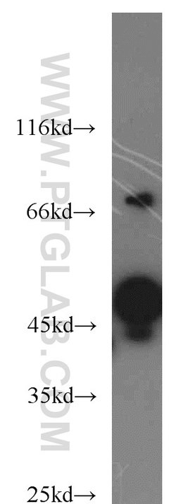 RCC1 Rabbit anti-Human, Mouse, Rat, Polyclonal, Proteintech:Antibodies:Primary