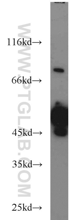 RCC1 Rabbit anti-Human, Mouse, Rat, Polyclonal, Proteintech:Antibodies:Primary