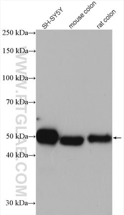 RCC1 Rabbit anti-Human, Mouse, Rat, Polyclonal, Proteintech:Antibodies:Primary