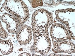 TCF4 Rabbit anti-Human, Mouse, Polyclonal, Proteintech:Antibodies:Primary