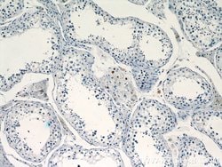 TCF4 Rabbit anti-Human, Mouse, Polyclonal, Proteintech:Antibodies:Primary