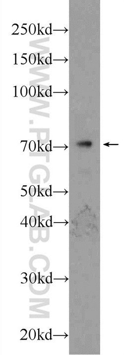 TCF4 Rabbit anti-Human, Mouse, Polyclonal, Proteintech:Antibodies:Primary