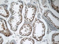 USP11 Rabbit anti-Human, Polyclonal, Proteintech 150 &mu;L; Unconjugated:Antibodies,