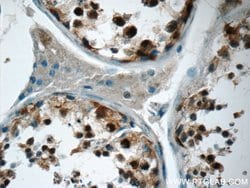USP11 Rabbit anti-Human, Polyclonal, Proteintech 150 &mu;L; Unconjugated:Antibodies,